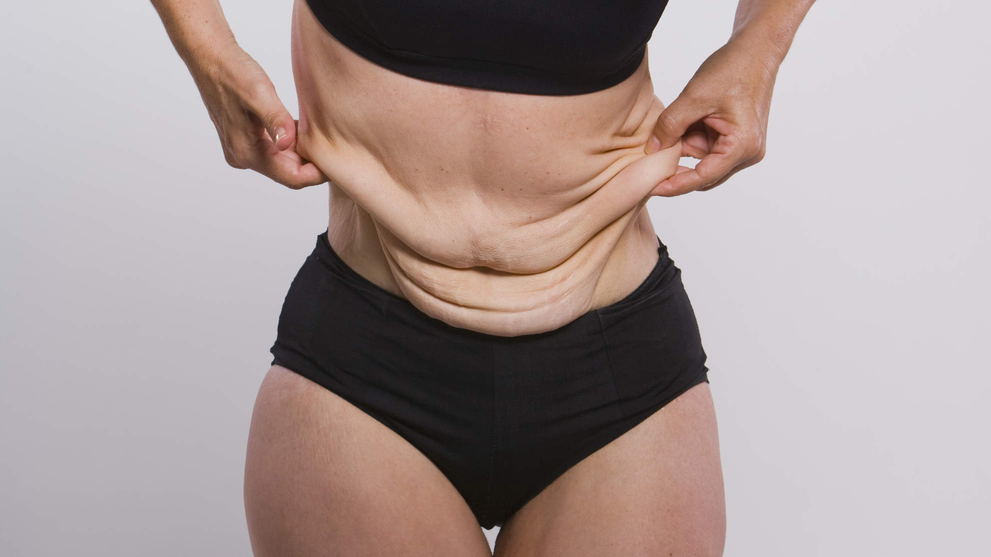 Body contouring surgery after weight loss