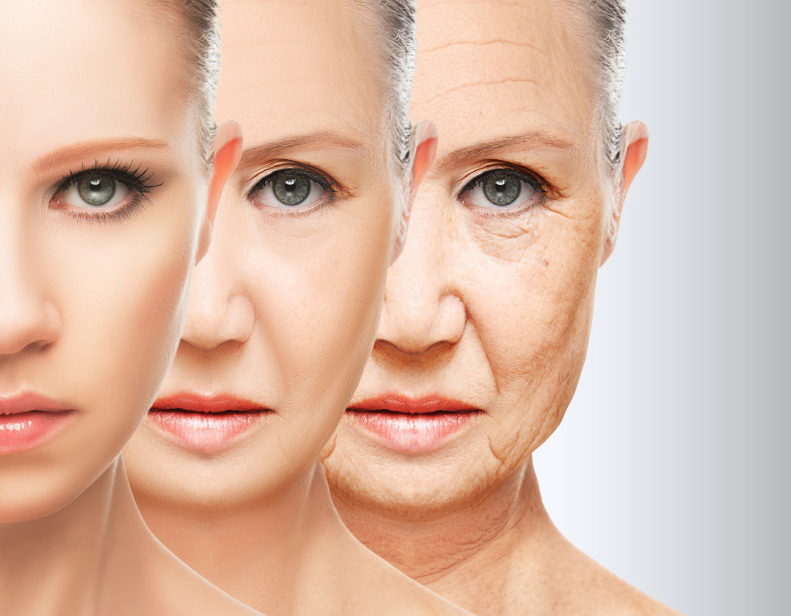 Facelift considerations